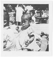 Child covered with sores due to malnutrition, Presbyterian Foundling Home, Taegu, ca. 1953.